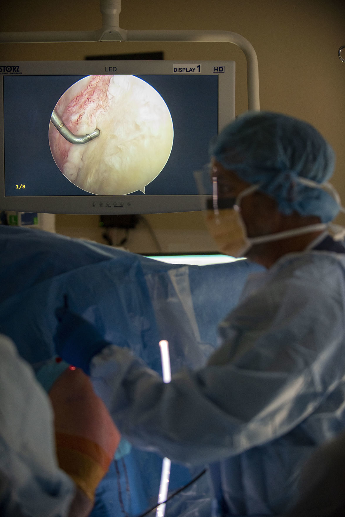 Rotator cuff surgery